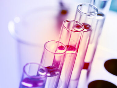 AADC Deficiency biomarkers