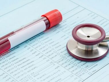 cerebrospinal fluid