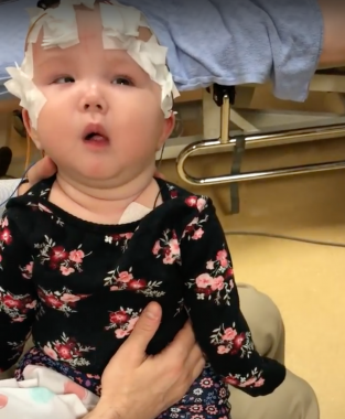 AADC symptoms | AADC News | Rylae-Ann has multiple sensors attached to her head and chest to monitor her brainwaves. Her arms and legs are tensing and twisting.