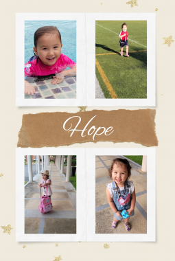 AADC deficiency treatment | AADC News | A photo collage of Richard's daughter, Rylae-Ann, with the word "Hope" in the center.