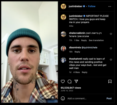 A screenshot of Justin Bieber on Instagram. Bieber is wearing a green stocking cap and flannel shirt, and in the video the screenshot is from, the right side of his face shows paralysis.