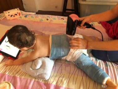 A toddler lies face-down on a pink and yellow bed, watching a tablet as her mom holds a blow dryer over the young girl's bottom, which is covered by a diaper over a large, blue spica cast that stretches from above the waist to the ankles on both legs. 