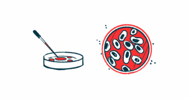 A petri dish is shown from two points of view, from beside it and looking down into it.