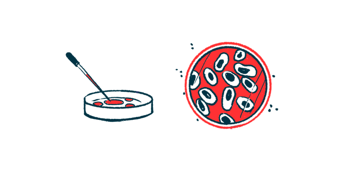 A petri dish is shown from two points of view, from beside it and looking down into it.