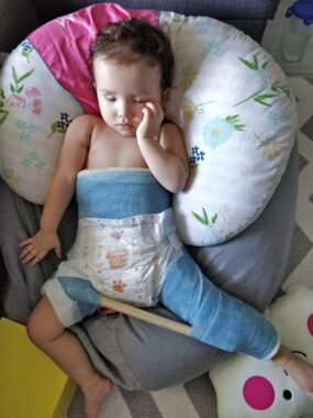 A young child lies on her back in a body cast.
